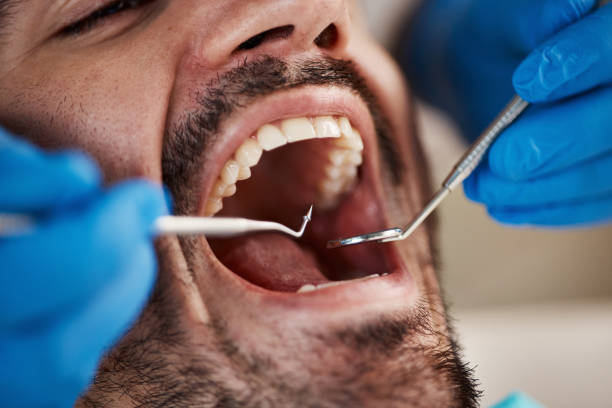 Best Emergency Treatment for Oral Infections in Gunnison, CO