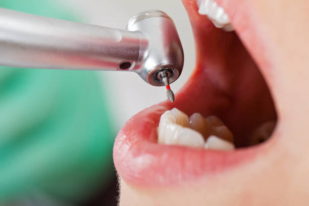 Best Emergency Treatment for Jaw Pain or Injury in Gunnison, CO